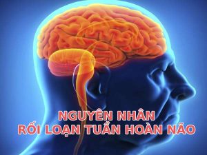 Nguyên nhân rối loạn tuần hoàn não là gì